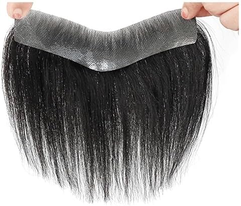 Forefrontal